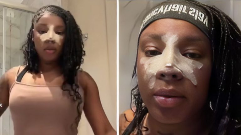 Dancing Rebel Speaks Out After Her Nose Job Receives Backlash: Video